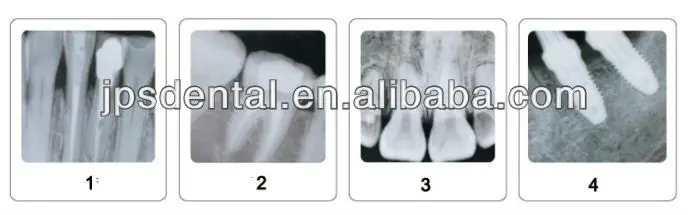 portable dental x-ray 2.jpg