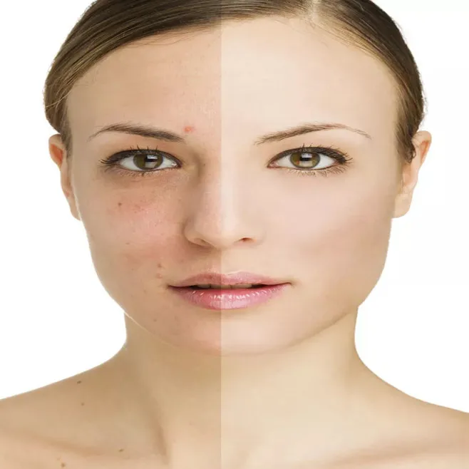 cosmetic raw materials sodium hyaluronate powder cas 9067-32-7 hyaluronic acid sodium