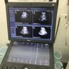 Sonoscape超音波マシンフルタッチスクリーンポータブル色ドップラー4d/ストレスエコー/ティーオプションソフトウェアsonoscape s9