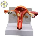 Artificial Uterus Ovary Female Genital Anatomy Model Medical Study Model