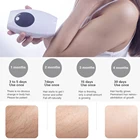 Ipl Ipl Laser Ipl The Best Electric Best Powerful Laser Ipl Home Women Epilator Permanent Hair Removal