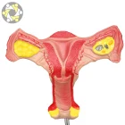 Female Internal Genital Organs Uterus Anatomical Model
