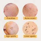 Whitening Cream Cream Organic Natural Skin Care Anti Wrinkle Whitening Dark Spot Removing Cream