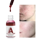 Magique Huaer AHA 30% And BHA 2% Peeling Solution Exfoliating Facial Whitening AHA Serum For Skin Care