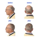 Anti bald sunburst treatment Herbs Hair Grow Lotion Effective Fast YUDA Hair Growth Spray