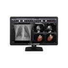 Medical diagnostic displays color display lcd screen