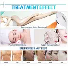 Hair Remove Ipl Skin Rejuvenation Machine Home
