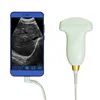 /product-detail/android-usb-ultrasound-probe-for-laptop-wireless-probe-ultrasound-60794013176.html