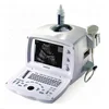 /product-detail/original-mindray-dp-2200plus-portable-full-digital-ultrasound-machine-black-white-62193100918.html