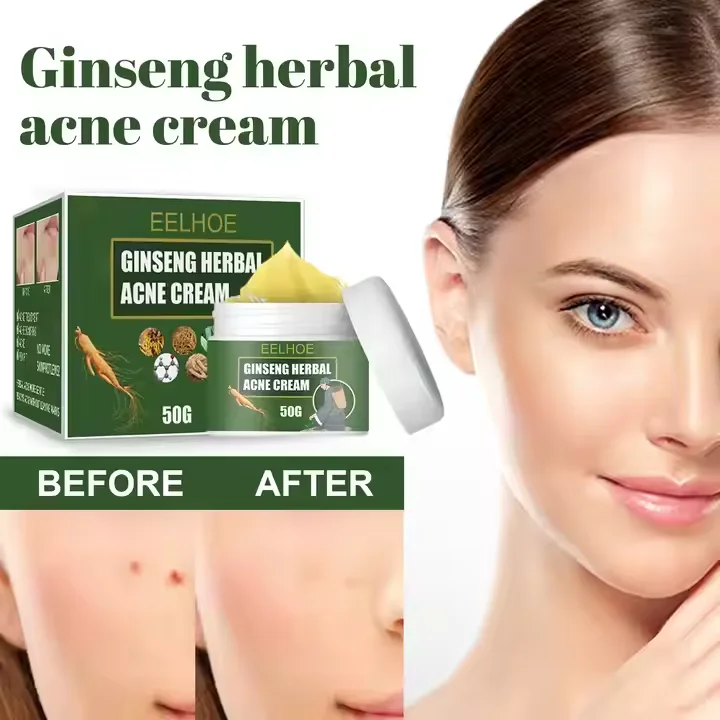 Cleans And Fades Acne Scars To Acne Repair Pit Ginseng Herbal Acne