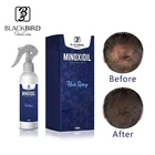 Private Label Effective Hair Growth Treatment Hair Growth Spray for Men Women Fast Hair Loss Treatment