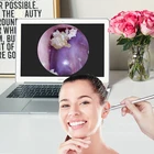 consumer ENT endoscope Application and Self check video otoscope Product Name wifi medical endoscope