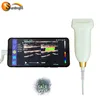 /product-detail/linear-android-usb-mini-ultrasound-probe-machine-ipad-ultrasound-62252066985.html
