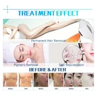 One-Stop Service 2020 Most Effectice Professional Opt Elight Soprano Shr Ipl Painfree Hair Removal Beauty Machine