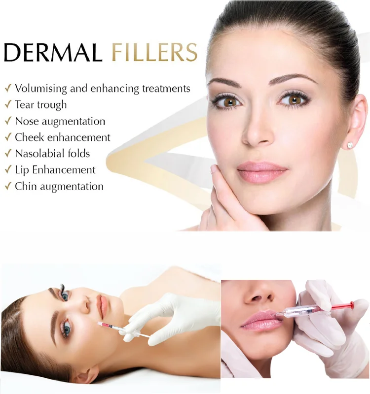 sale hyaluronic acid injection hyaluronic acid dermal fillers