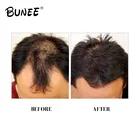 OEM hair thickening solution anti hair loss hair growth serum