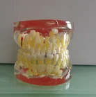 BIX - L1006 Transparent baby teeth pathological dental model