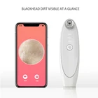 3 In 1 Facial Vacuum Blackhead Remover Visual Pores Cleaner