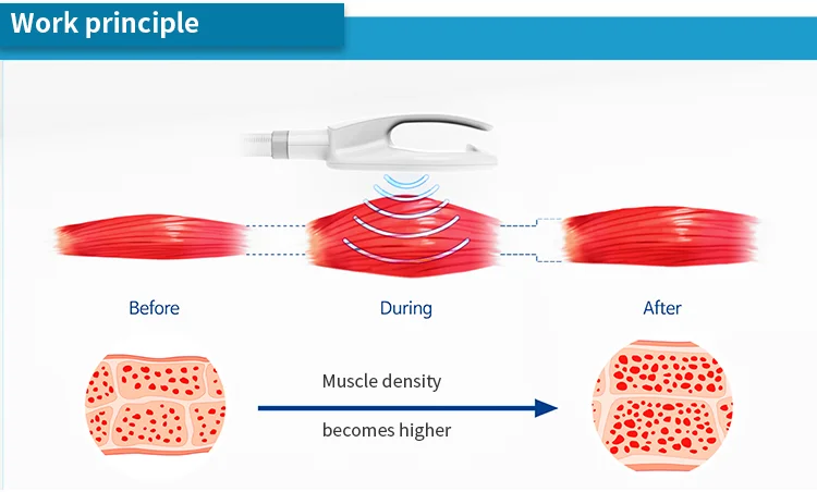 2021 black for building body shape and weight loss Cellusculpt muscle building slim fat removal