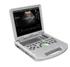 /product-detail/am-l5-laptop-color-doppler-echo-doppler-with-cardiac-probe-ultrasonido-3d-new-tech-usg-62314358598.html