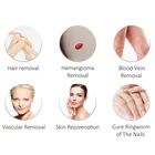 Laser Nd Yag No Long Pulse Nd Yag Laser Candela Gentlemax Pro Alexandrite Laser Hair Removal Machine