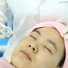 Exfoliators Machine Handheld Exfoliators Easy Peel Crystal Diamond Head Microdermabrasion Machine