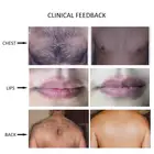 Beautemax approved professional permanent vertical diode laser 808 hair removal beauty laser equipment