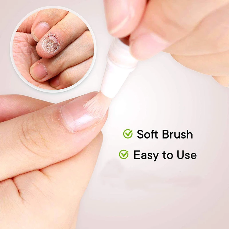 cracked, rough, nail discolorations, brittle and split toenails