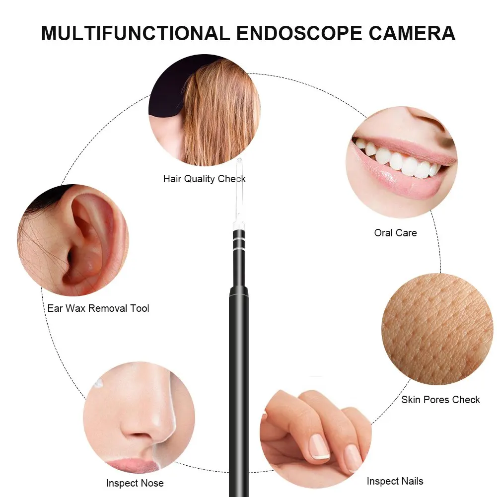 ear endoscopie