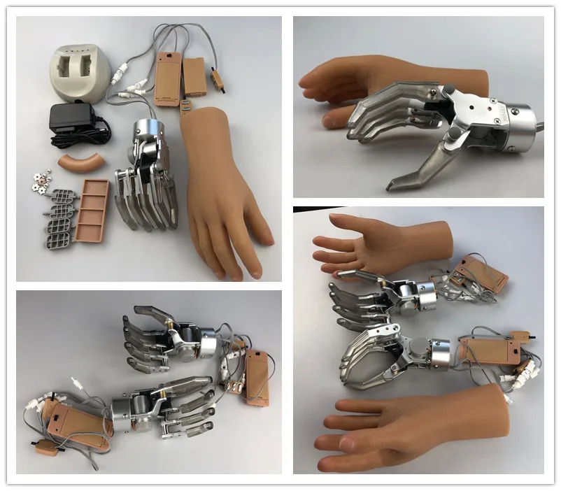 Artificial Limbs Cable Control Style Prosthetic Hand Prosthetic Arm