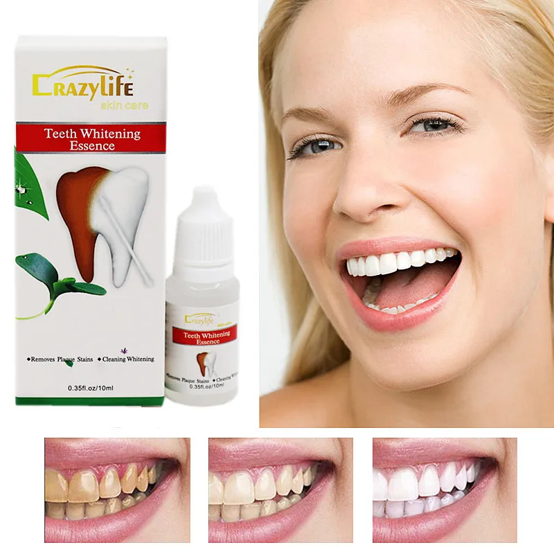 teeth whitening (2).jpg