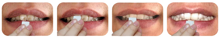 use-magic-teeth strips.jpg