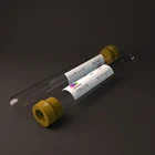 Health Medical Dental Instrument Implant Supply PRF Tube