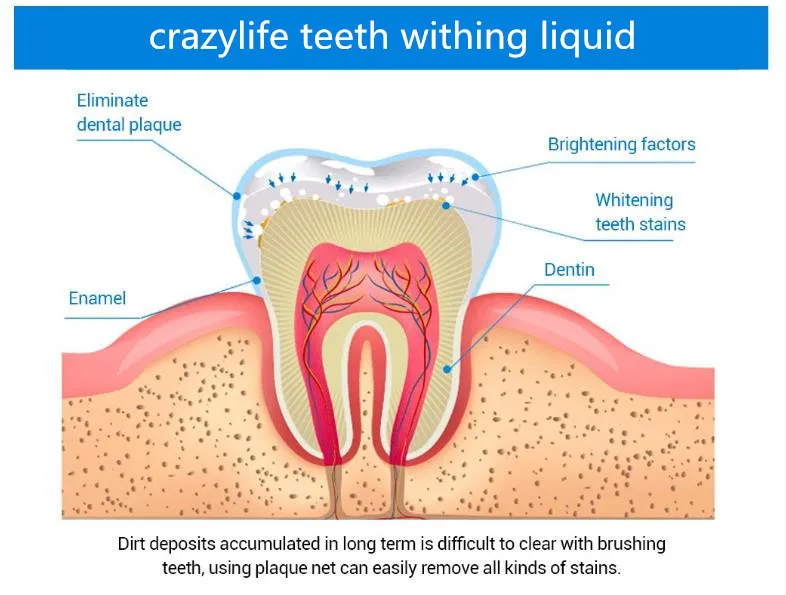 teeth whitening (5).jpg