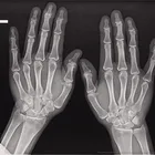 14*17inch agfa medical x ray dry film for hot dry films