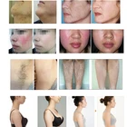 Face Lift 2020 Ipl Laser Hair Remover Shr Epilation