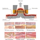 Portable Rf Vacuum Face Slimming Machine Body Vacuum Suction Weight Loss Machine