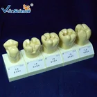 High Quality 4 Times Single color Cavity Preparation Dental Teaching Teeth Model