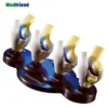Factory Price Advanced Anatomical 4-stage Osteoarthritis Knee Model