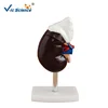 Hogh quantity Plastic Human Kidney anatomical model with Adrenal Gland