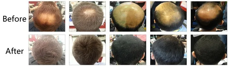 Anti Hair Loss Product Fully Hair Building Fiber Spray Oem Buy