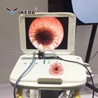 rhinoscope endoscope/portable endoscope equipment system