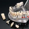 Some Can be Temovable Orthodontic Dental Teeth Teachering Model or Pathological dental model