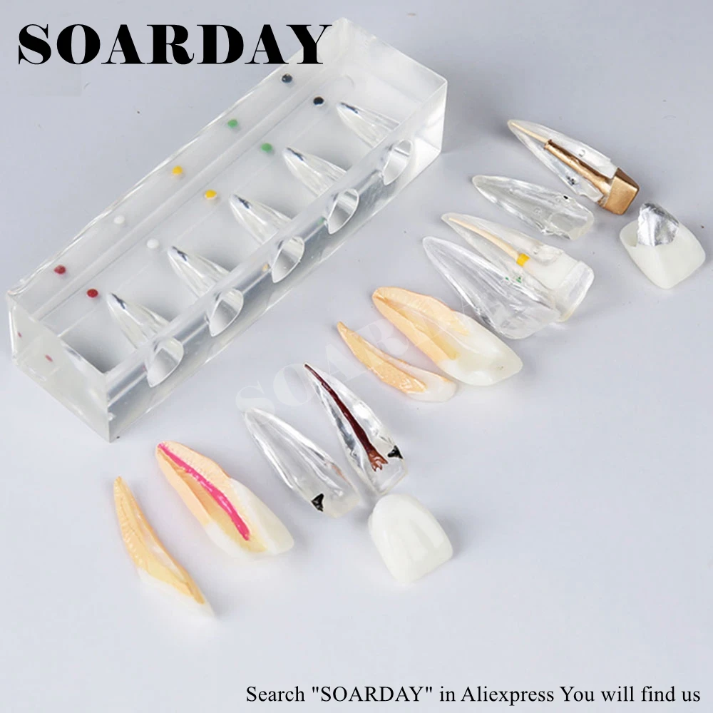 Endodontic Restoration Model (2)