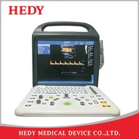 HEDY Portable Latop Color Doppler Ultrasound