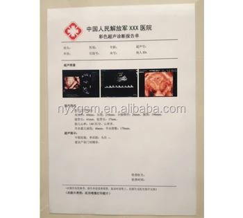 laser film digitizer