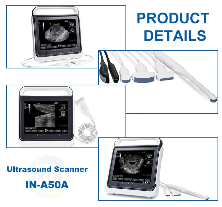 Ultrasound Scanner Portable Laptop