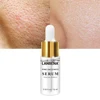 LANBENA pore tighten minimizing serum pore treatment lotion