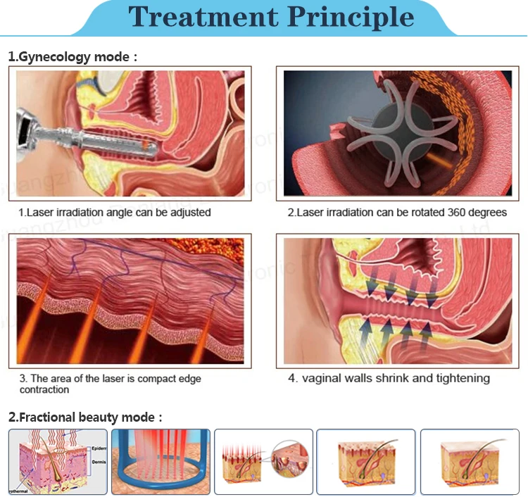 Treatment-Principle.jpg
