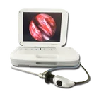 Logo Customization Endoscope Rigid Ent Portable Ent Endoscope Camera for Rigid Ent Endoscope